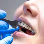 Daily Oral Hygiene Tips for Healthy Teeth and Gums