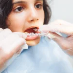 The Ultimate Guide to Your Child’s First Dental Visit: Ending Dental Anxiety Before It Starts